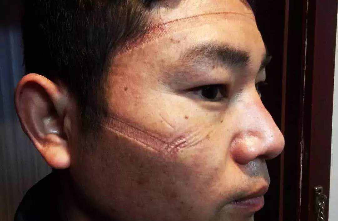 湖北省首次！首次给辅警记三等功